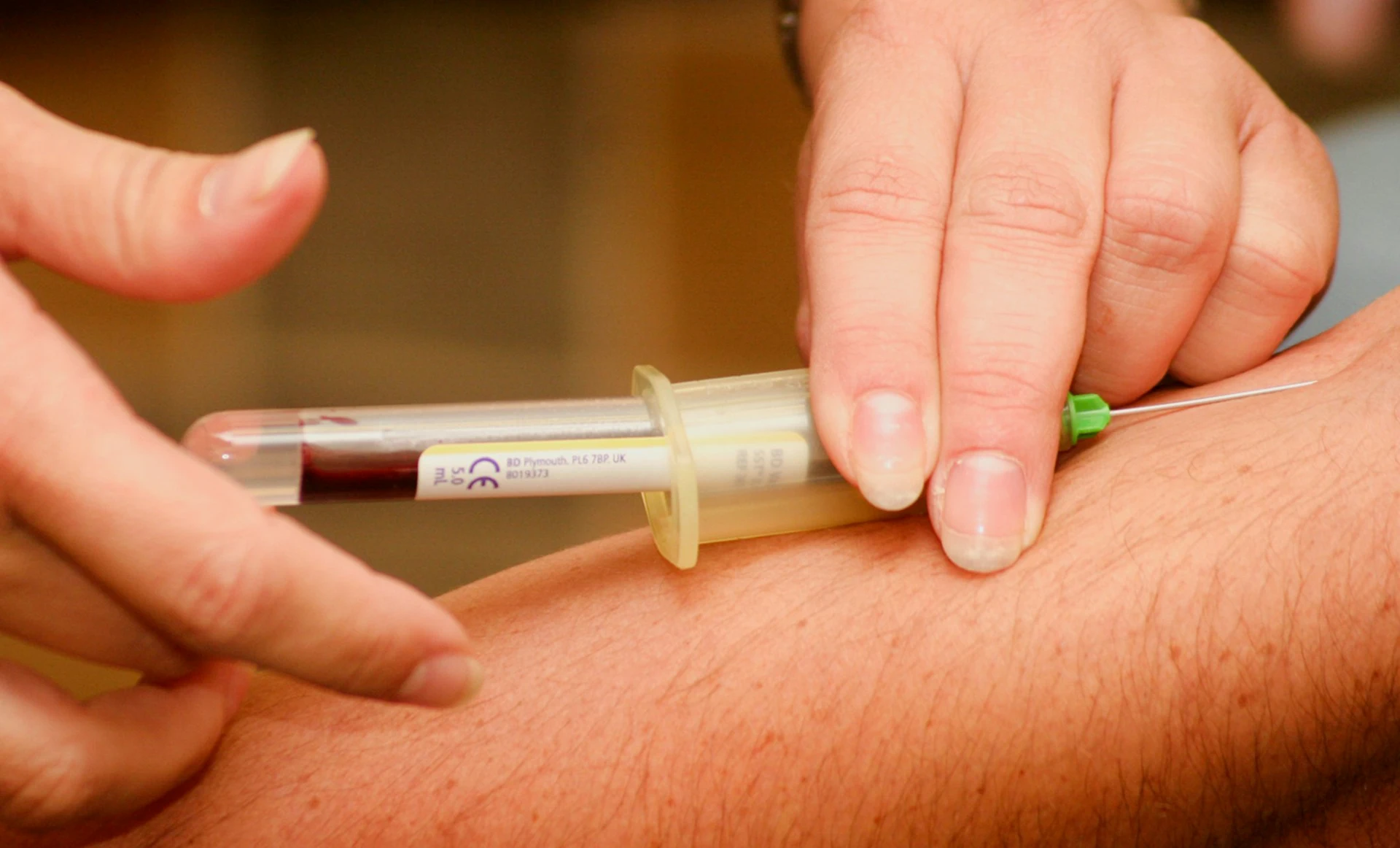 Close-up of a medical professional collecting blood from a patient's arm with a needle and vacuum tube.